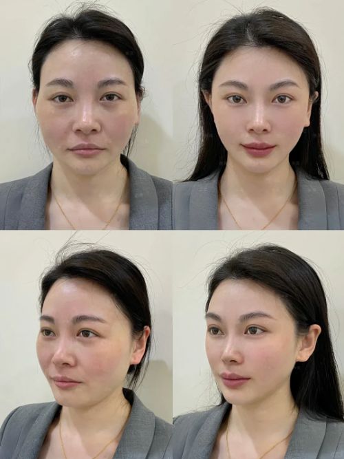 50岁抗皱紧致十大品牌给你紧致肌肤开元棋牌网站抗衰老的护肤品排行榜(图3)